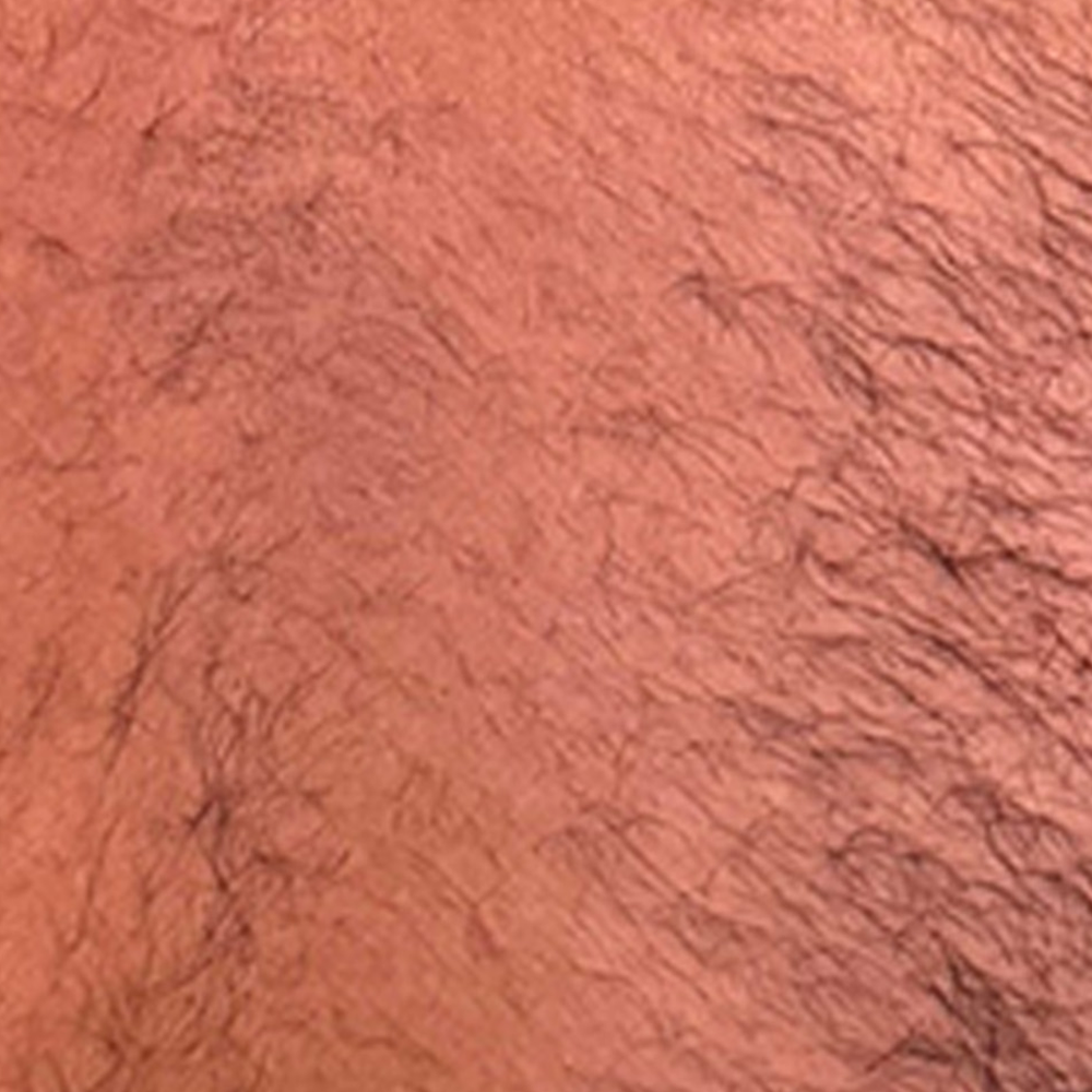 DiolazeXL Before