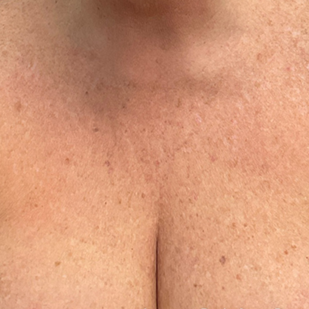 P6_AD_LP_Female_Chest-TM_0001_Lumecca After
