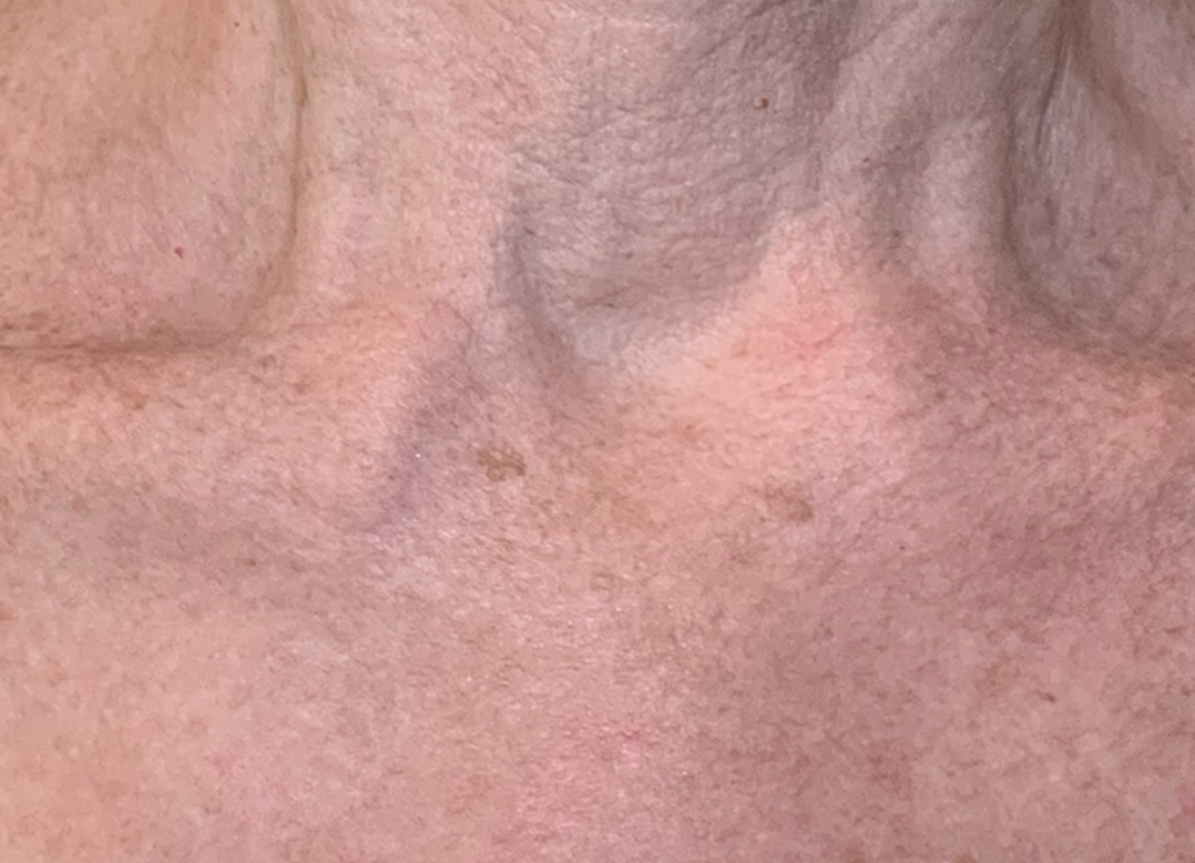 JS_Lumecca_Peak_Chest_Fem-TM copy
