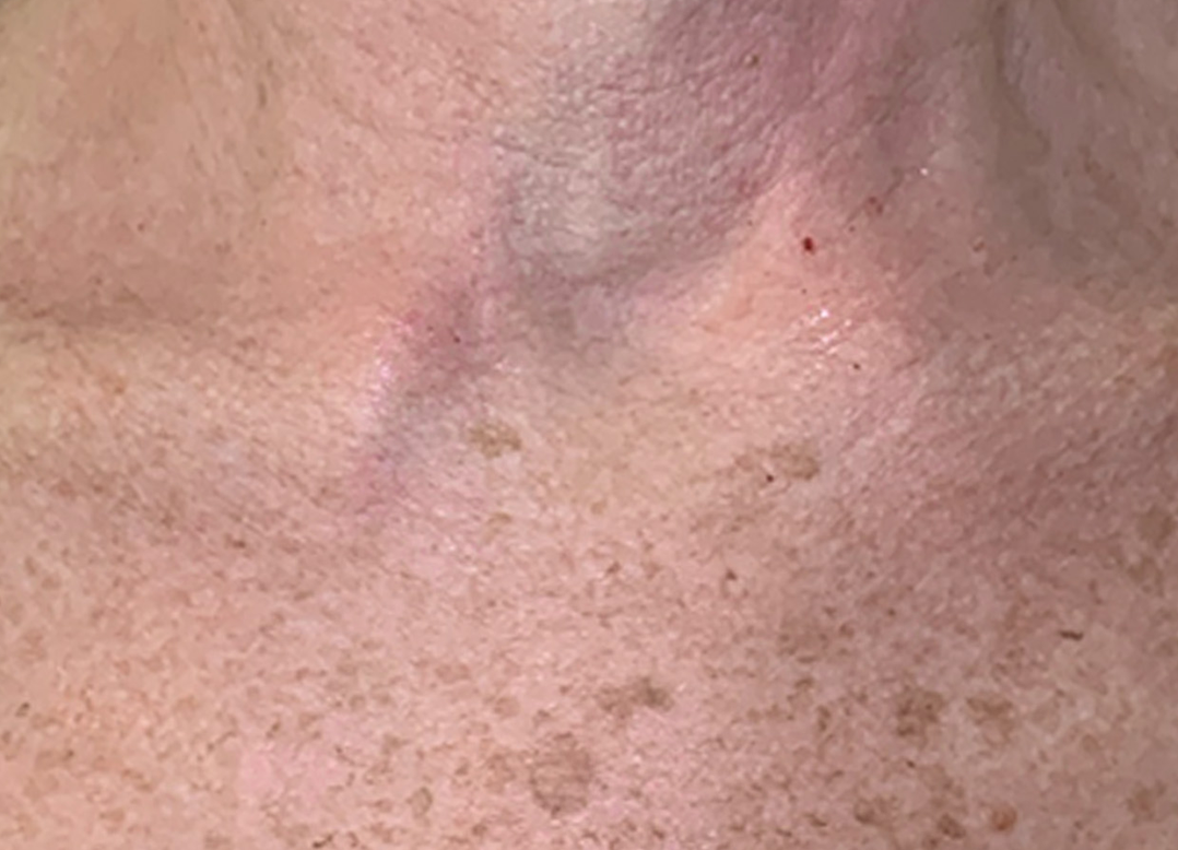 JS_Lumecca_Peak_Chest_Fem-TM