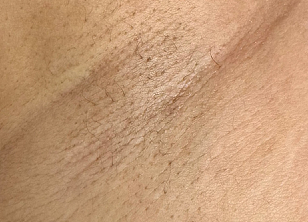 NL_Fusion_Airpit_Crop-TM copy